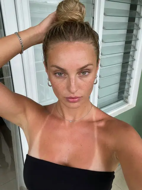 Hot summer balcony selfie: clear sun marks on skin